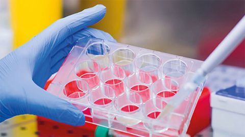 Jackson ImmunoResearch Launches Secondary Antibodies for VHH Discovery