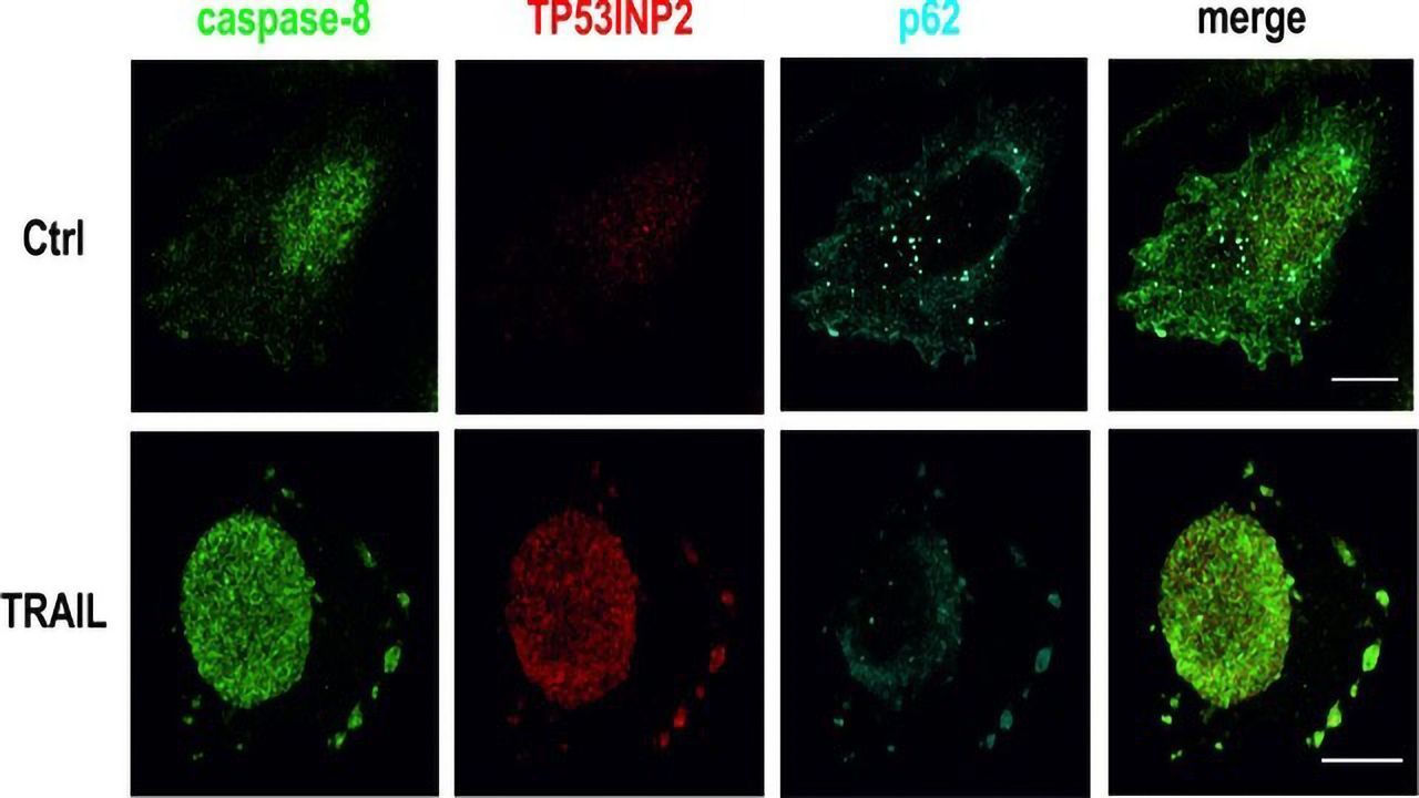 New Biomarker for Personalized Treatments Against Cancer