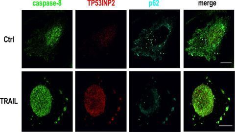 New Biomarker for Personalized Treatments Against Cancer