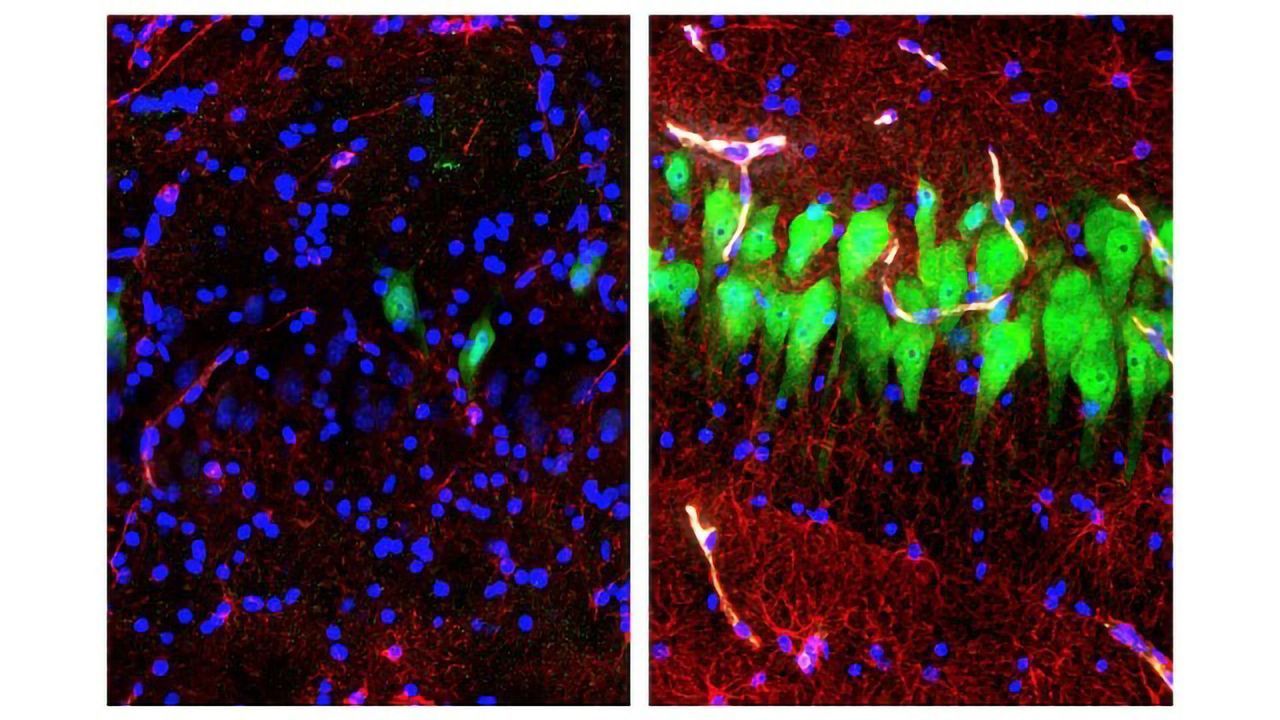 Researchers Restore Synaptic Activity and Circulation to Four-hour Dead Pig Brain