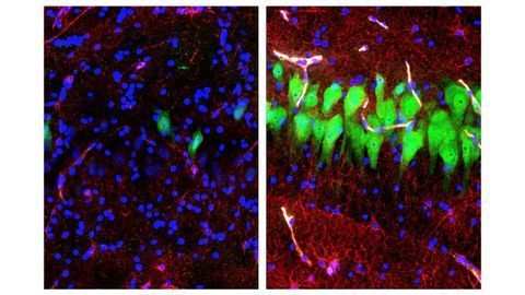Researchers Restore Synaptic Activity and Circulation to Four-hour Dead Pig Brain
