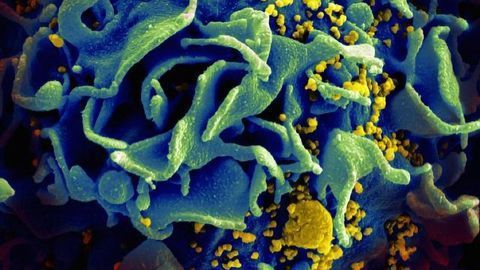 HIV Suppressed for up to Four Months by Novel Antibody