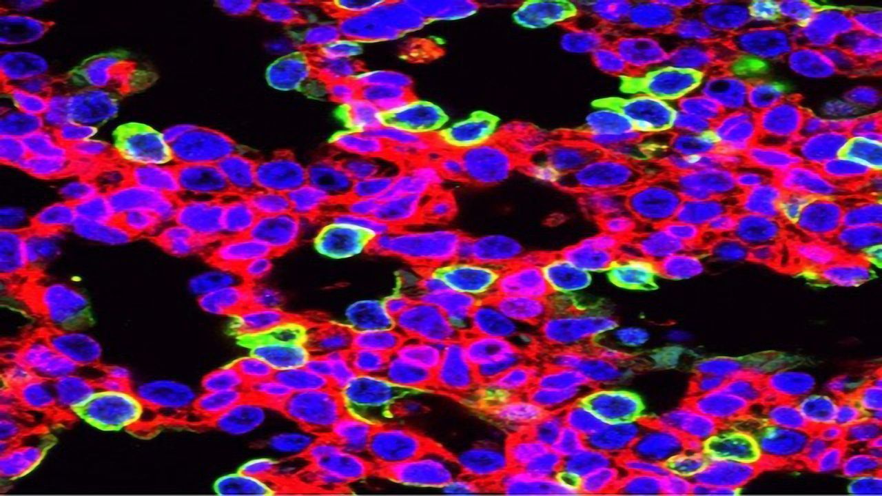 CRISPR Treats Lethal Lung Disease Before Birth in Animal Model