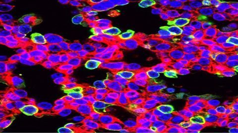 CRISPR Treats Lethal Lung Disease Before Birth in Animal Model