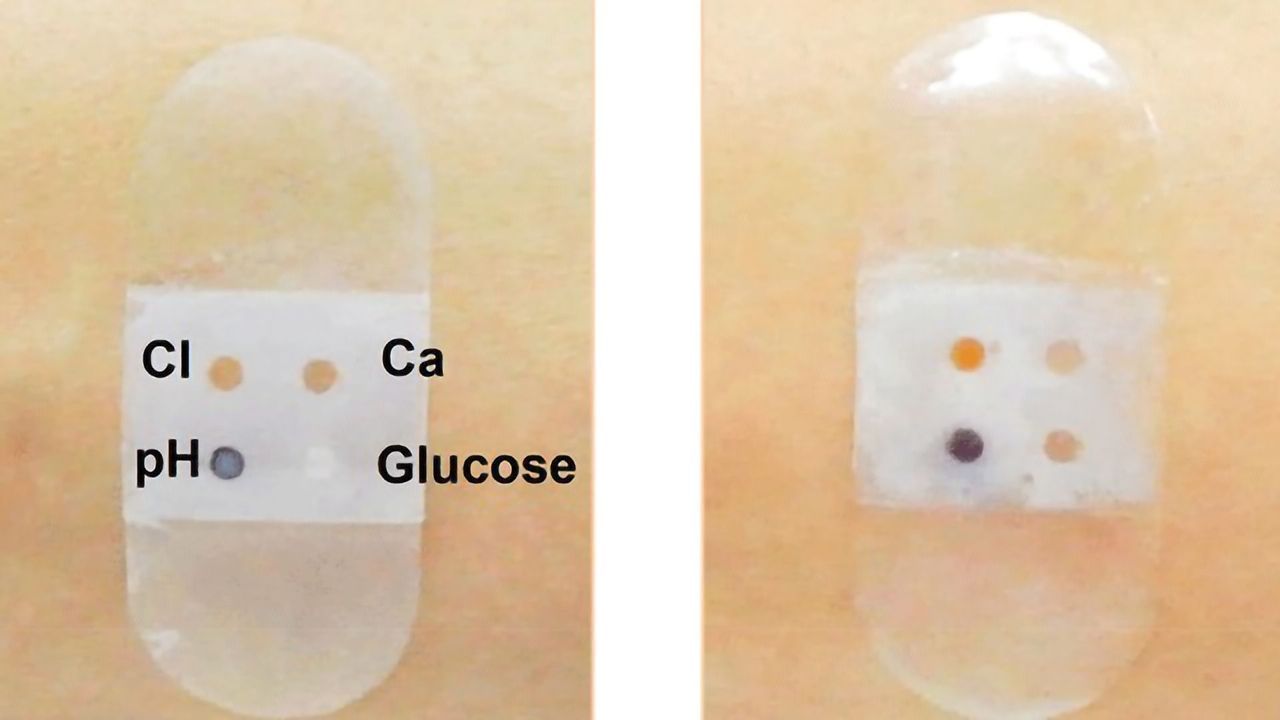 Biosensor Bandage Collects and Analyzes Sweat