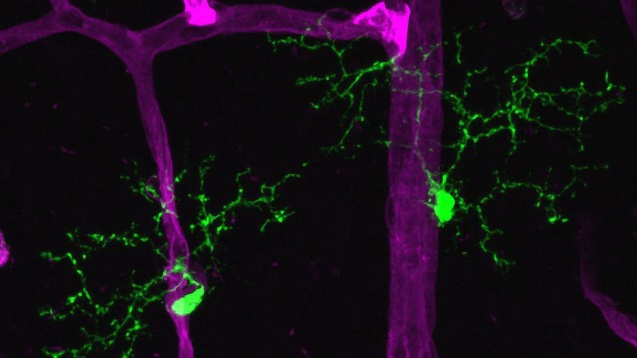 Microglia Limit Photoreceptor Damage in Sight-threatening Model