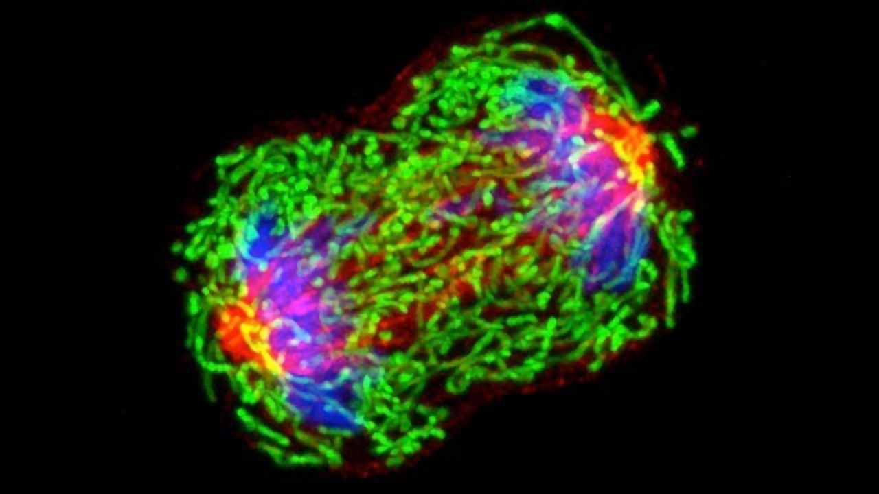 Triple-negative Breast Cancers Can Adopt Reversible State That is Resistant to Chemotherapy