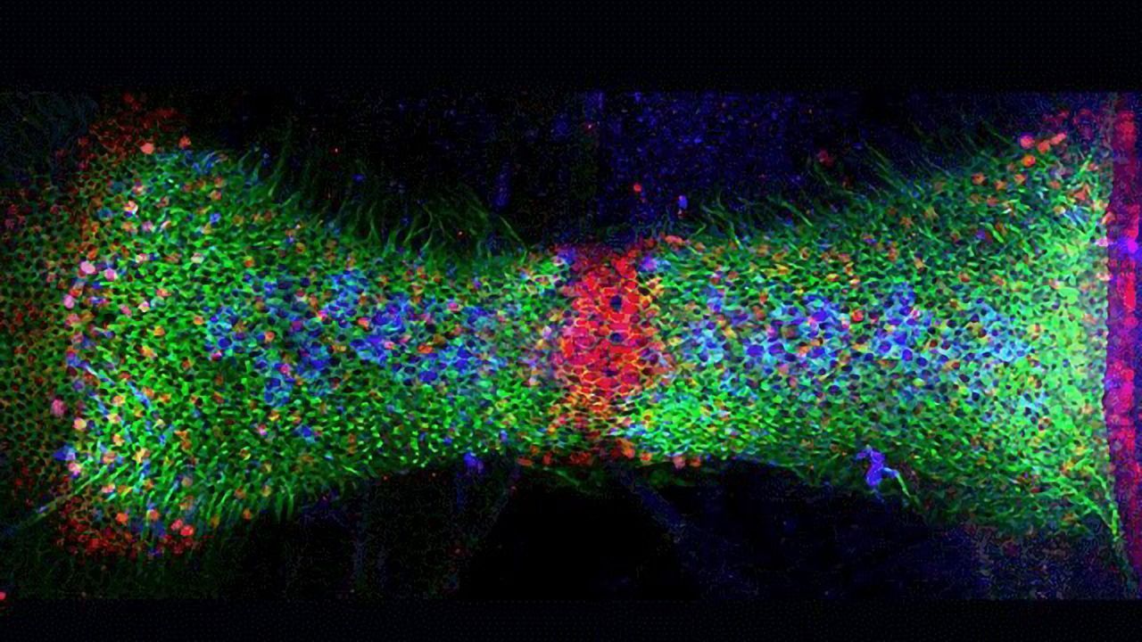 Pursuing Hair-restoration Therapy – For Your Inner Ear