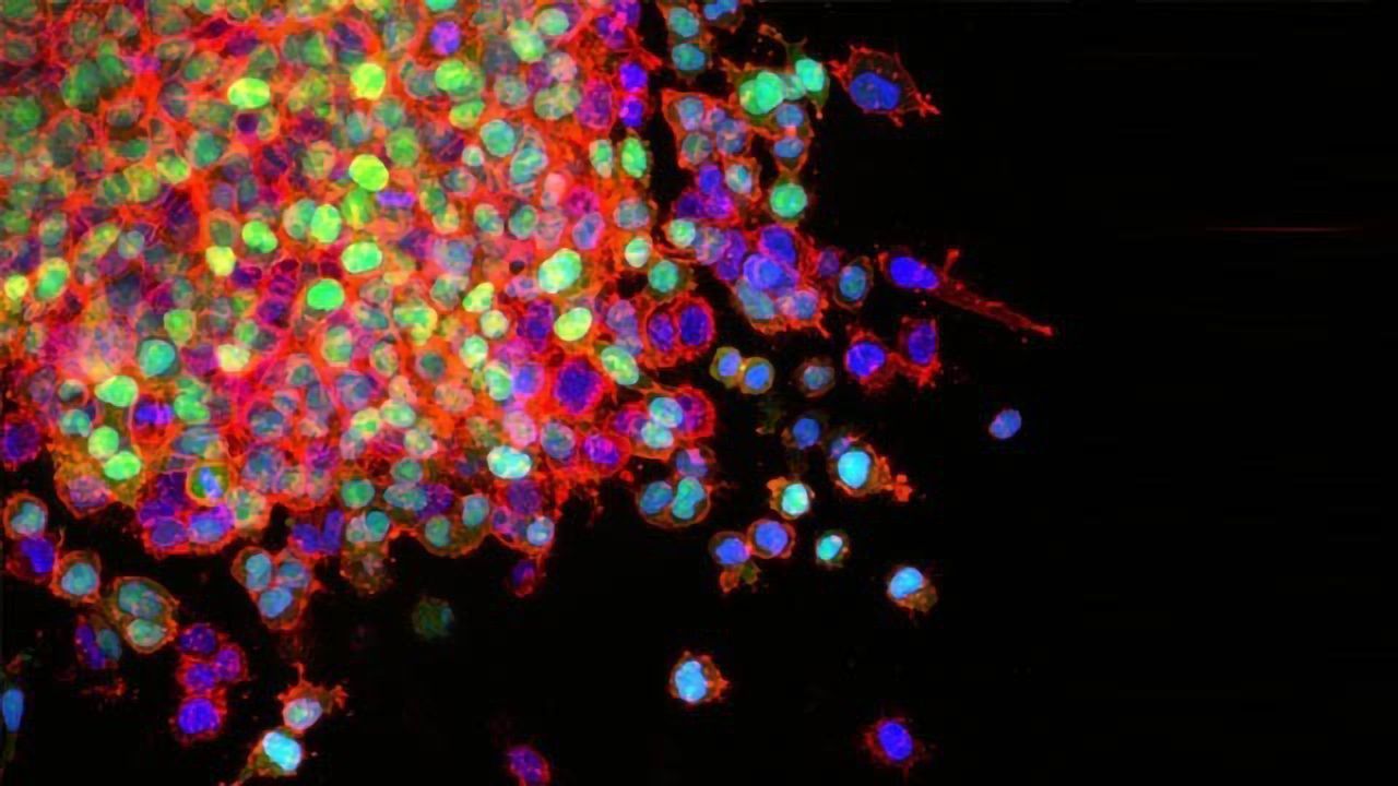 Biologists Design Molecules That “Starve” Lung Cancer Cells