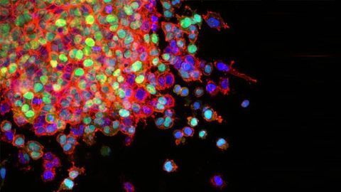 Biologists Design Molecules That “Starve” Lung Cancer Cells