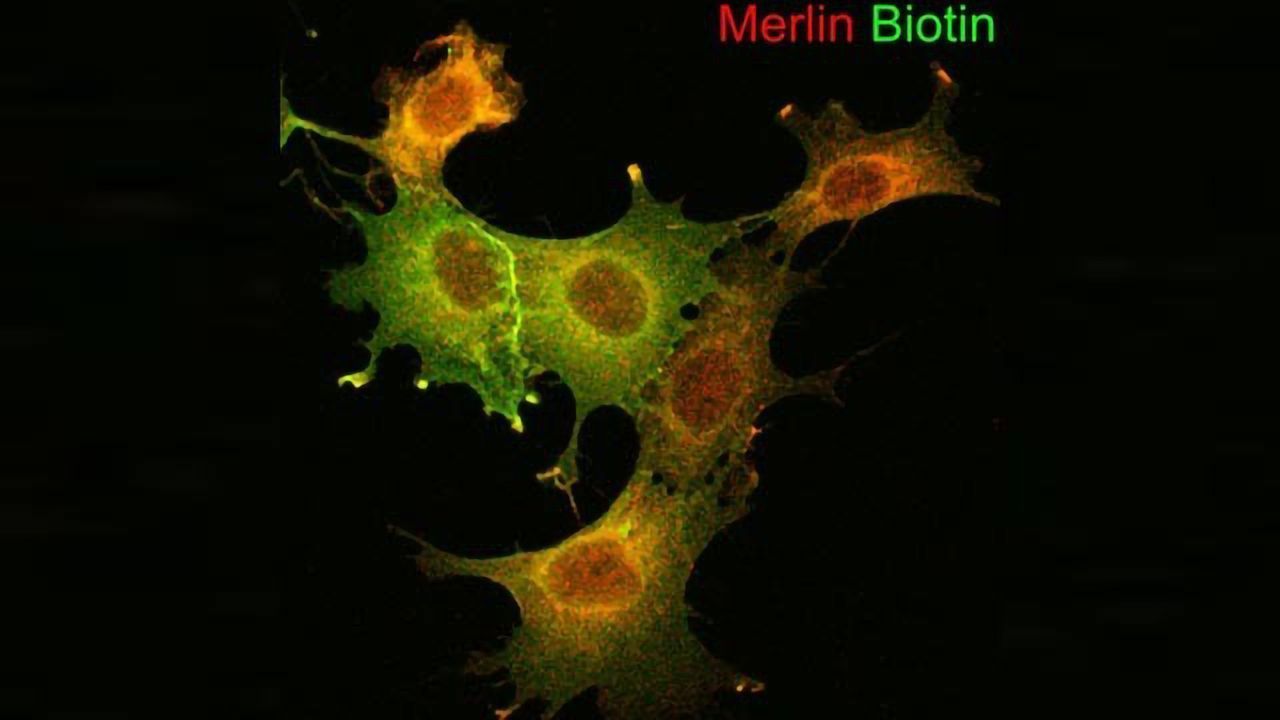 Shining a Light on Rare Nerve Tumors