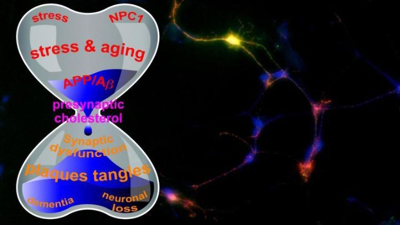 Amyloid Precursor Protein: Master or Accomplice in Alzheimer's?