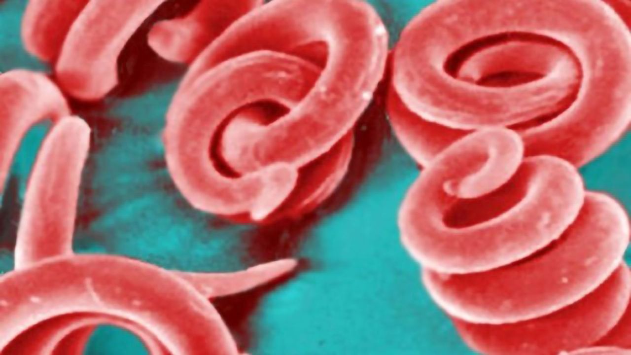 Pork Parasite Fought by Multipurpose Immune Pathway