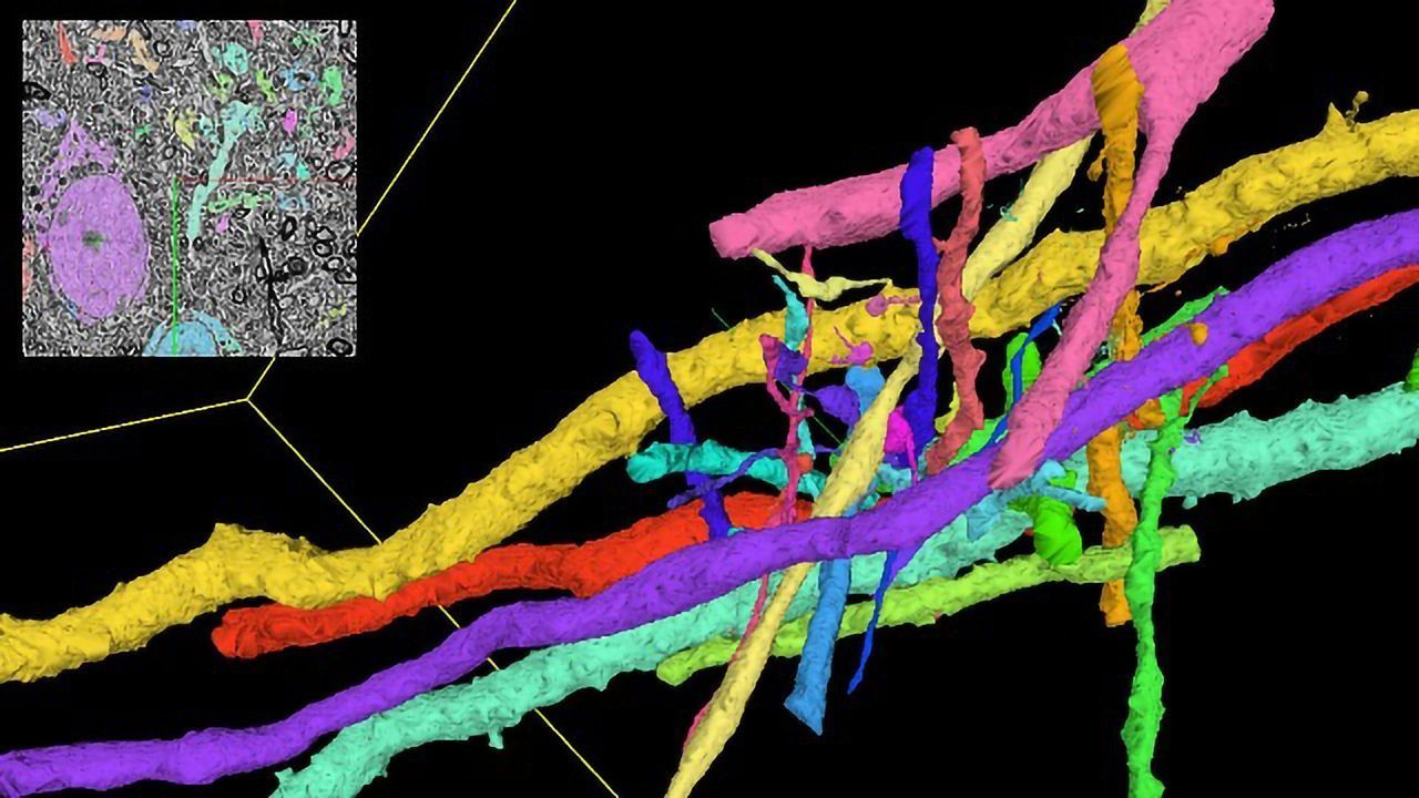 Exascale Computing to Unlock the Mysteries of the Human Brain