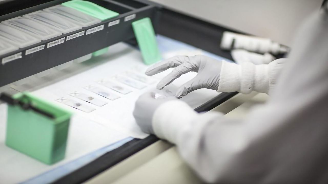 Gene Test for Breast Cancer Decreases Cost of Care Nationwide