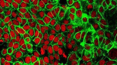 Exposing and Exploiting Cancer’s Metabolic Addictions