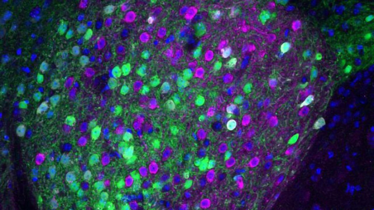 The Neurobiology of Noshing