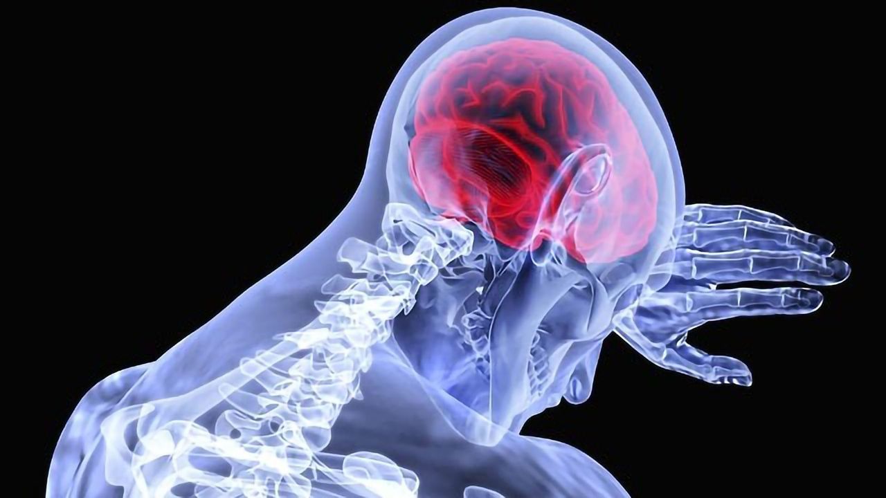 Drugs to Prevent Stroke and Dementia Show Promise in Early Trial