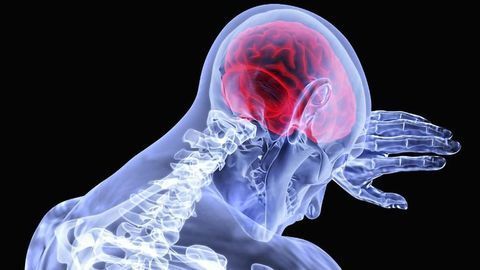 Drugs to Prevent Stroke and Dementia Show Promise in Early Trial