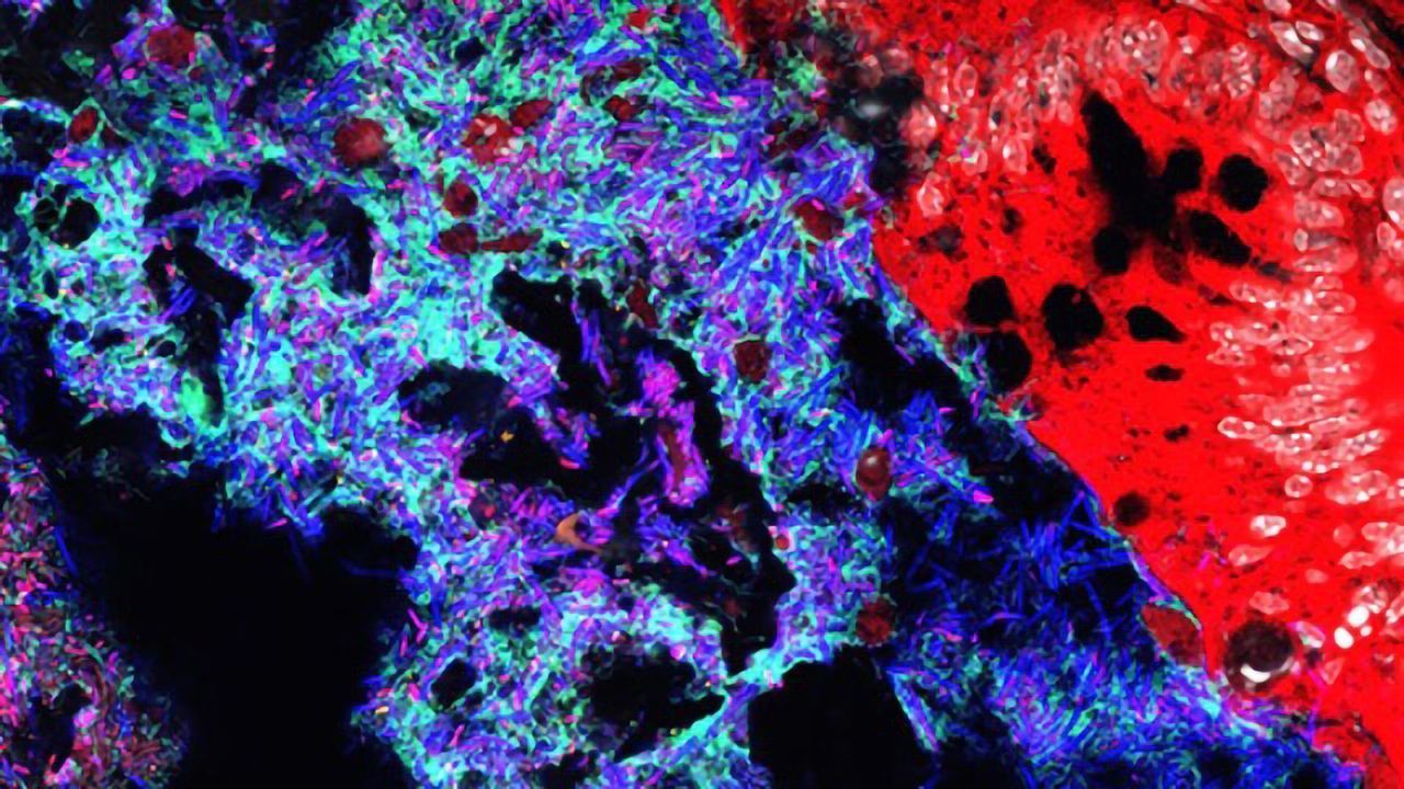 Gut Bacteria That Battles Salmonella Infection