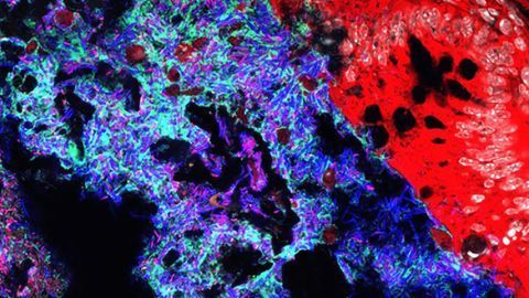 Gut Bacteria That Battles Salmonella Infection