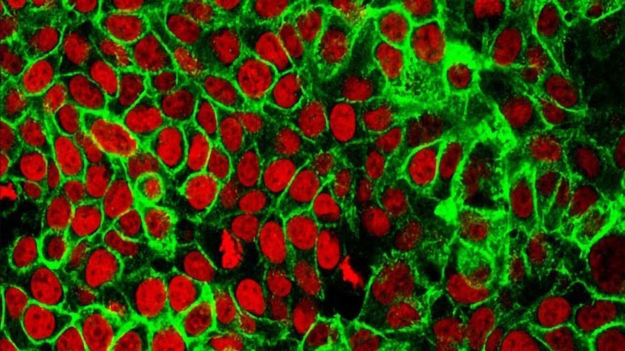 Colorectal Cancer Vaccine Proves Safe in Phase I Trial