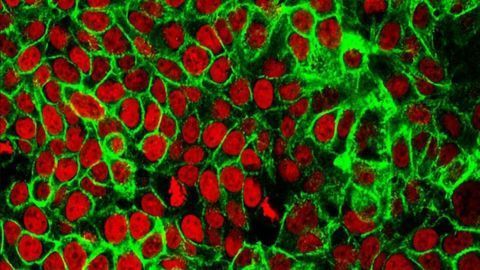Colorectal Cancer Vaccine Proves Safe in Phase I Trial