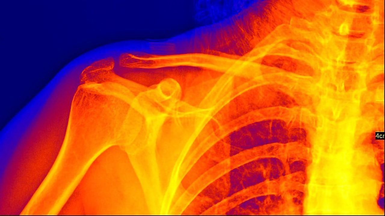 A Roadmap for AI in Medical Imaging
