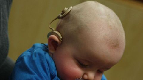 NHS to Fund Brain Surgery for Deaf Children