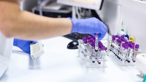 Flow Cytometry in the Clinic