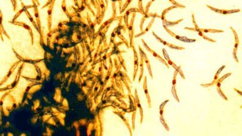NIH Reaffirms Commitment to "Zero Malaria" Goal