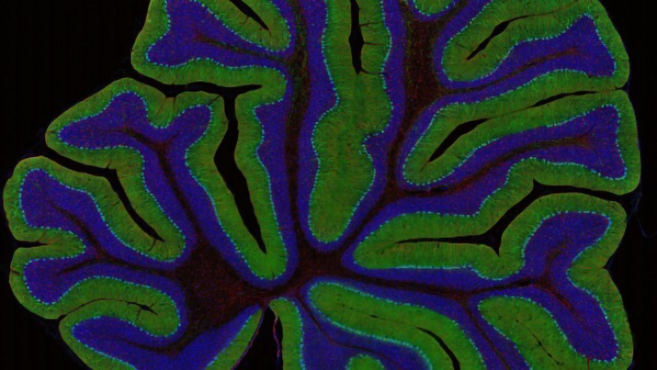 The Spectacular World of Brain Imaging