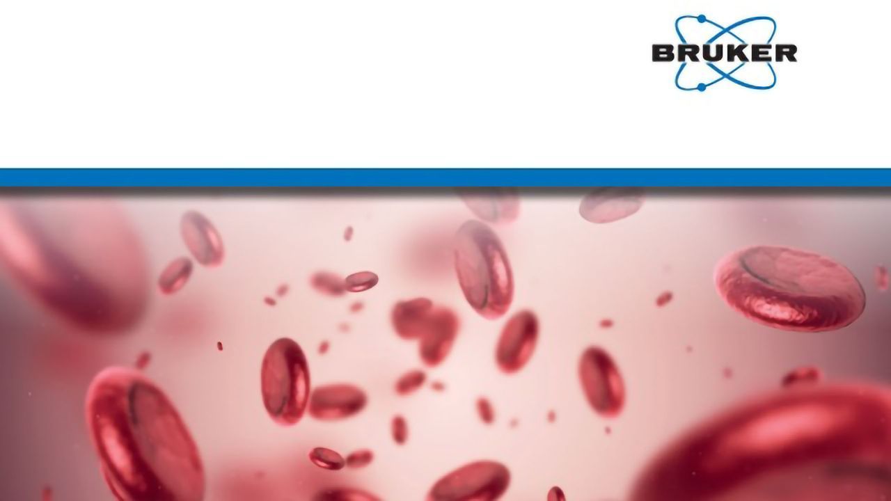 Quantify 500 Plasma Proteins in 11.5 Minutes Using timsTOF Pro With PASEF and 4D Feature Alignment