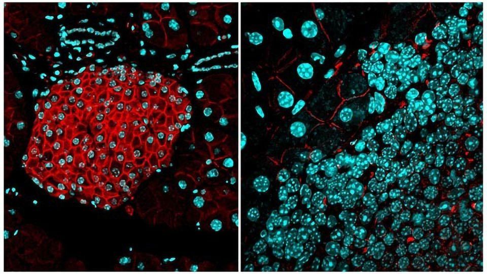 Biological “Barrier” Keeps Cancer at Bay content piece image