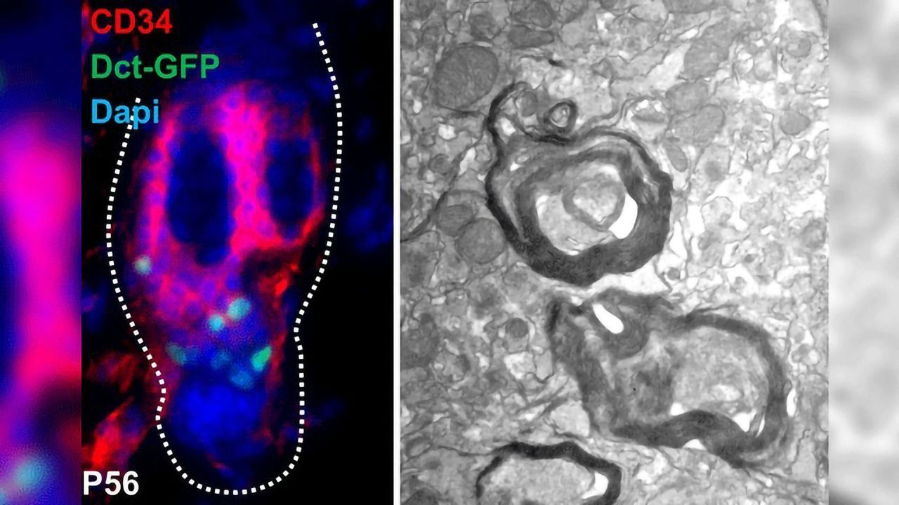 Skin-derived Stem Cell has Potential to Regenerate Myelin Sheath