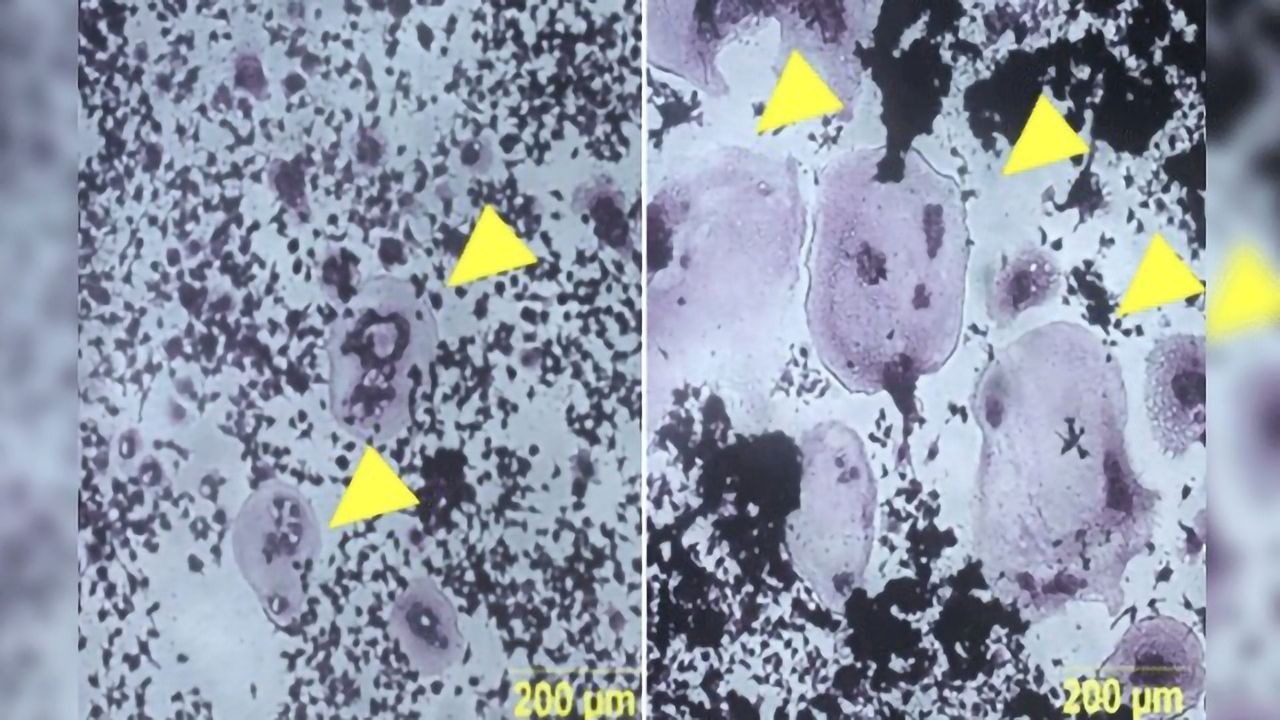 How Toxin Exposure Can Weaken Your Bones