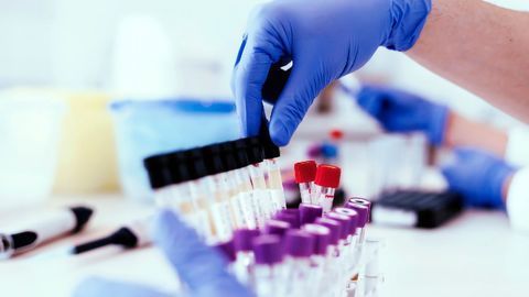 A Better Lifecycle for Analytical Methods?