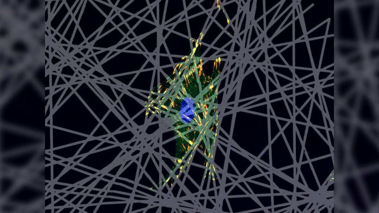 Cell Migration: Clinical Relevance, Unique Movement Patterns and Driving Technologies
