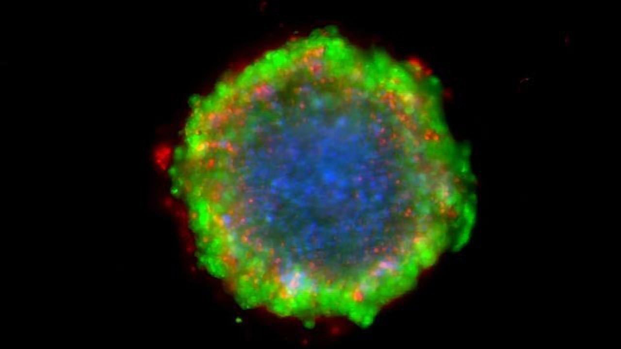 Testing Personalized Treatments in 5 Days With 3D