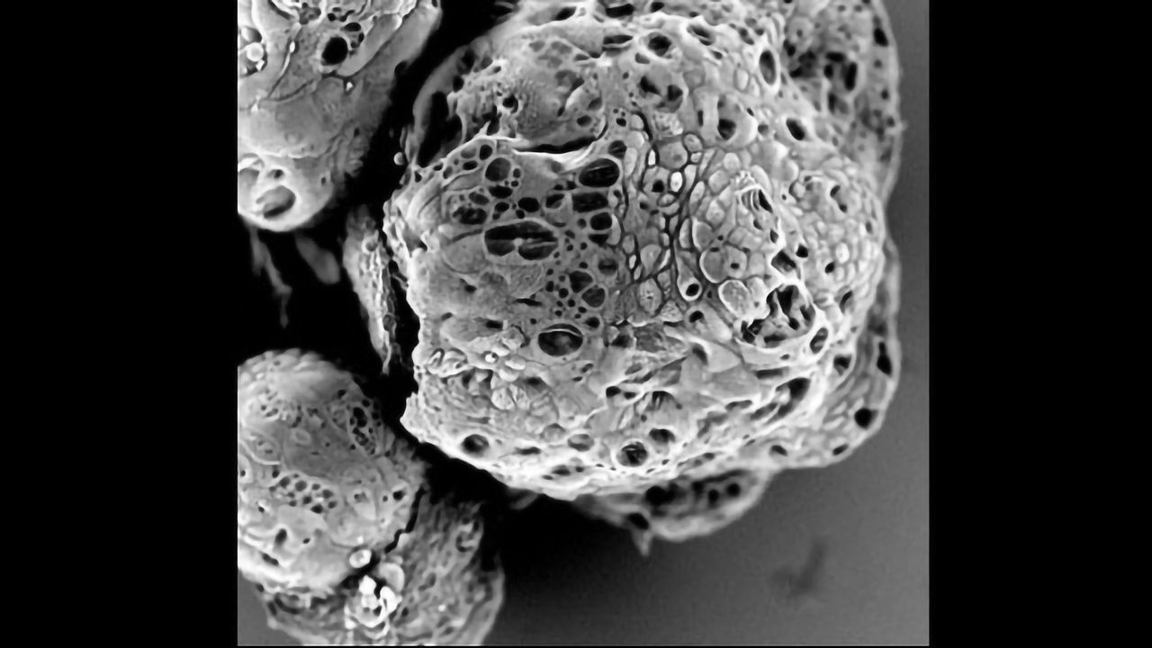 Uncovering the Function of Liver Cancer Genes in Mini-organs
