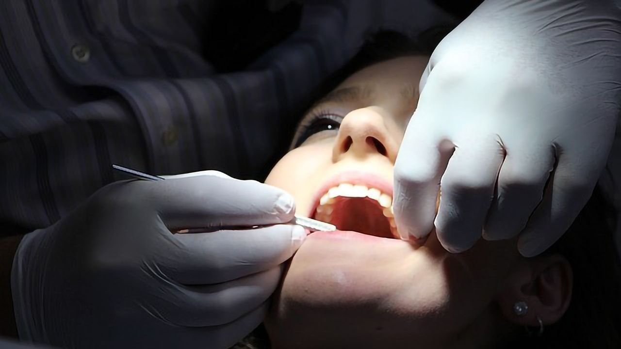 Direct Link Between Oral Bacteria and Stroke