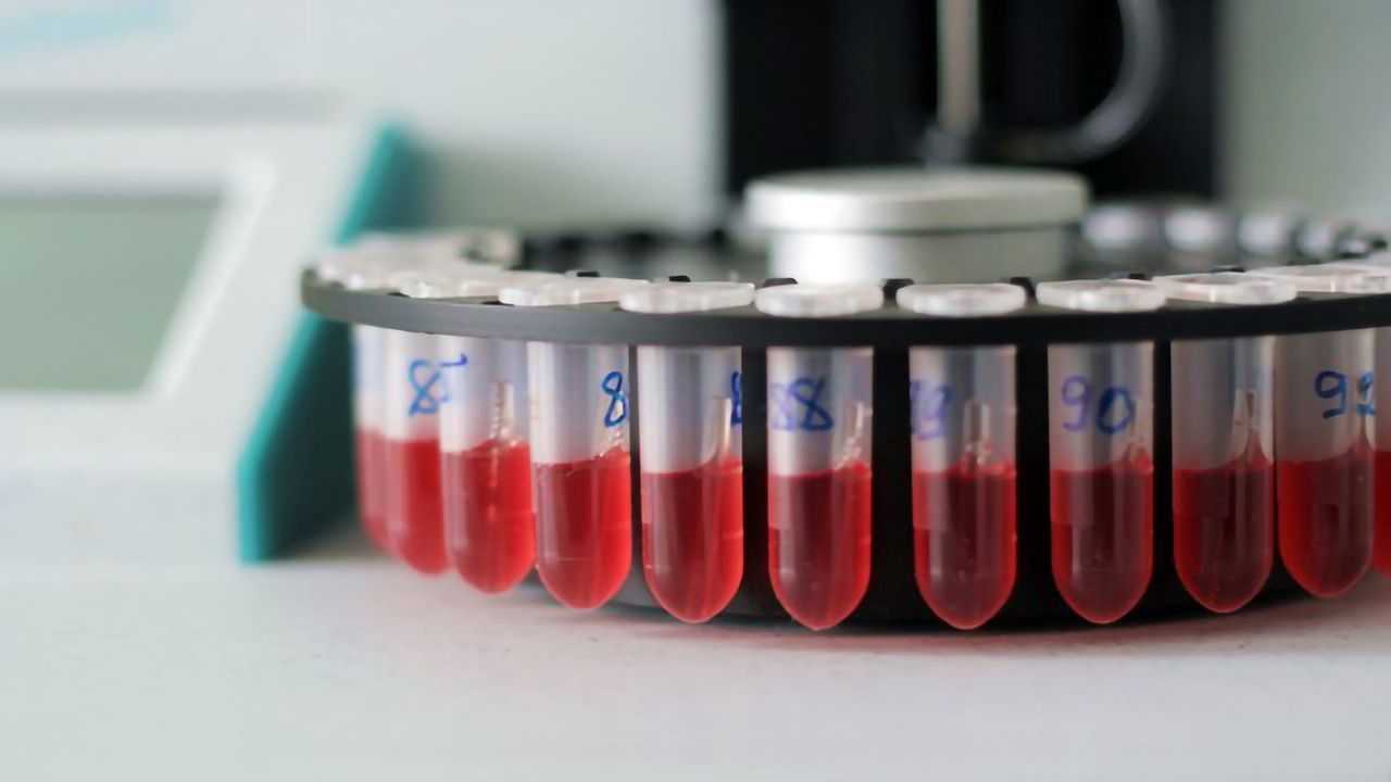 First Large-scale Genetic Analysis of the Human Plasma Lipid Species