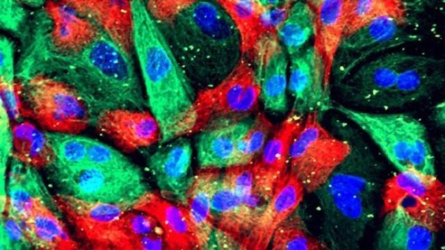 Prostate Cancer Cells Mimic Bone-forming Cells When They Metastasize content piece image 