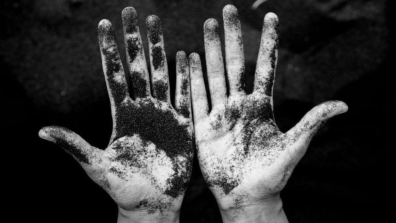 Anti-inflammatory Fat Found in Dirt may Curb Stress-Related Disorders
