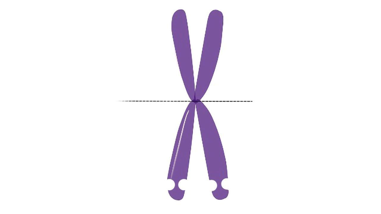 Statin Treatment Slashes Symptoms of Fragile X Syndrome in Rats
