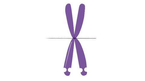 Statin Treatment Slashes Symptoms of Fragile X Syndrome in Rats