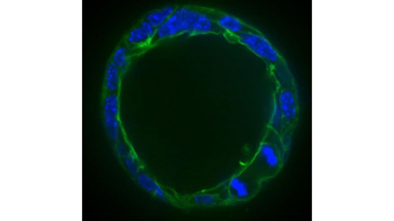 3D Organoid Culture Crucial for Chromosome Segregation
