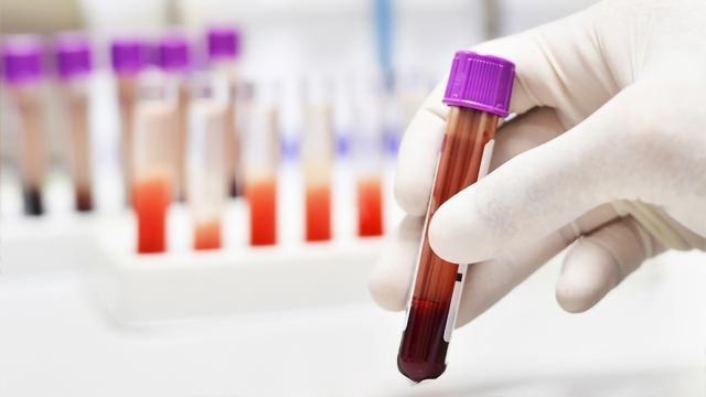 Breast Cancer: Blood Test Predicts Response to New Drug at Start of Treatment content piece image 