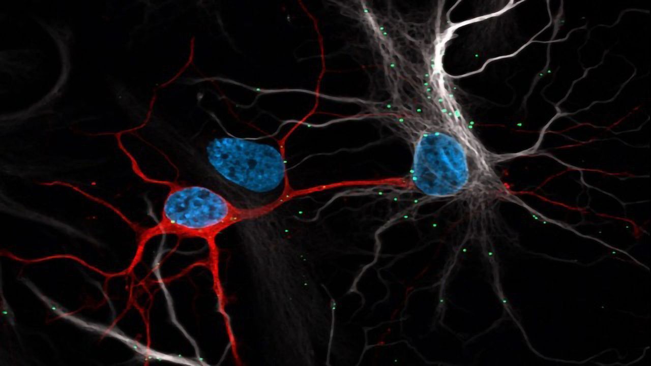 Astrocytes Protect Neurons From Toxic Buildup