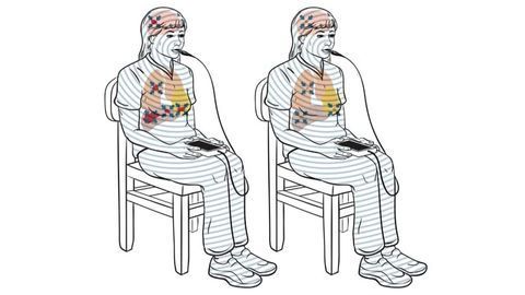 Radio-wave Therapy Blocks Growth of Liver Cancer Cells